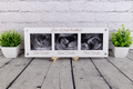 Love at First Heartbeat 3 Trimester Sonogram Frame